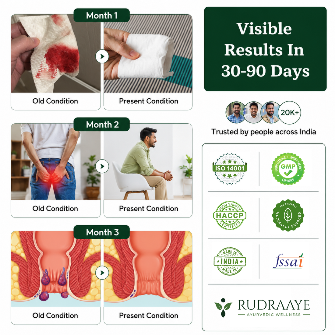 Rudraaye Pilexo+ | Piles Relief for Pain, Bleeding & Swelling | 1 Month Pack